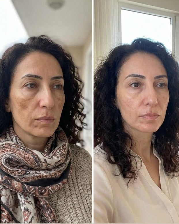 Zerdeçal İçeren Nazik Peeling Pedleri  & Cildiniz Parlasın