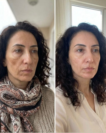 Zerdeçal İçeren Nazik Peeling Pedleri  & Cildiniz Parlasın