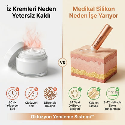 Zedra İz Giderici Kalem