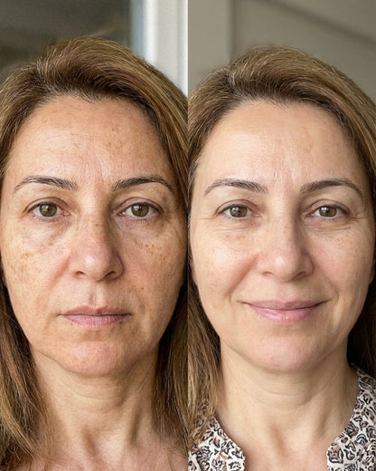 Zerdeçal İçeren Nazik Peeling Pedleri  & Cildiniz Parlasın
