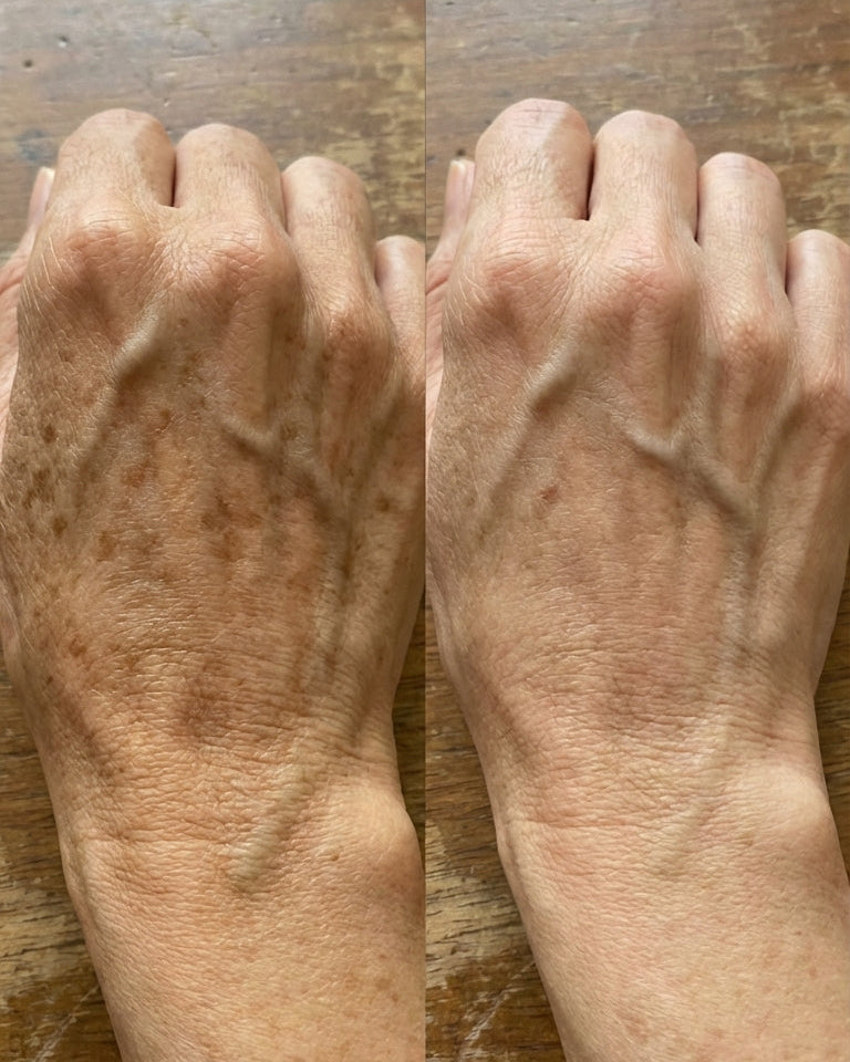 Zerdeçal İçeren Nazik Peeling Pedleri  & Cildiniz Parlasın