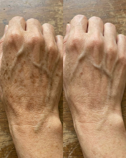 Zerdeçal İçeren Nazik Peeling Pedleri  & Cildiniz Parlasın
